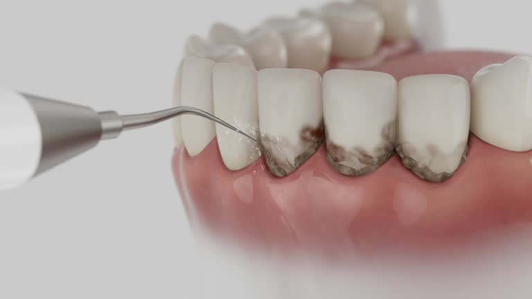 Trusted Root Canal Treatment service in Egypt Lake-Leto, FL - Dentist Open Now